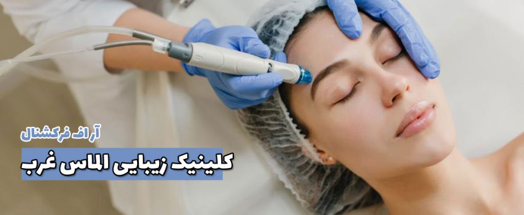 آر اف فرکشنال