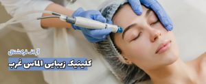 آر اف فرکشنال