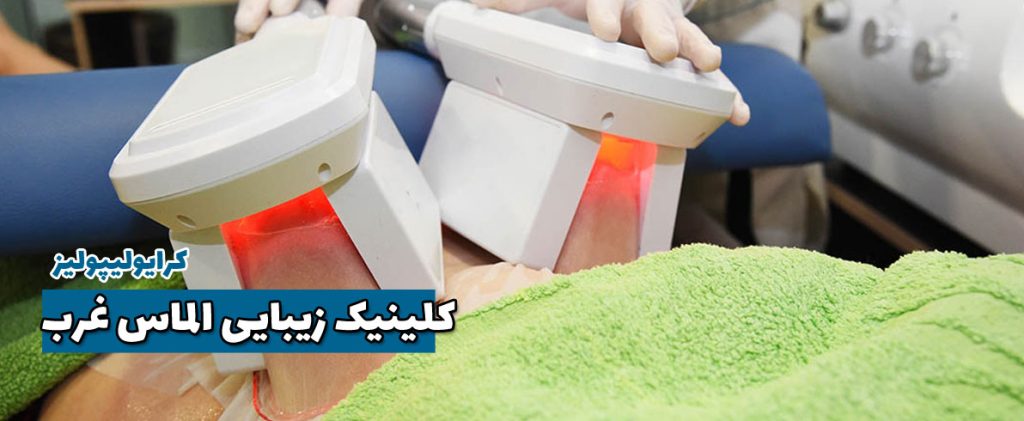 کرایولیپولیز در غرب تهران