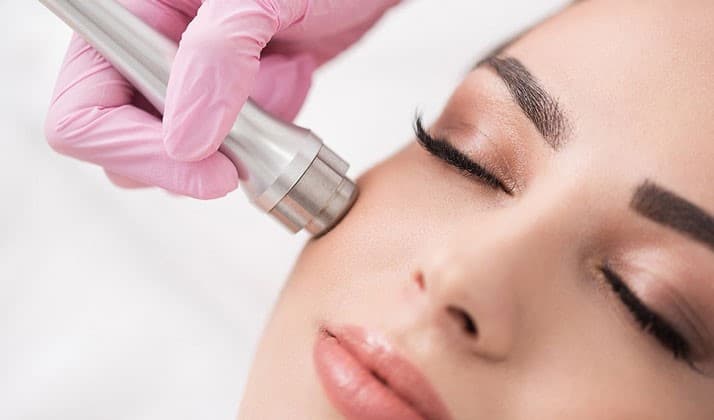 Some Advantages Of Microdermabrasion Over Other Skin Treatments