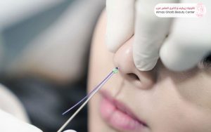 هزینه نخ بینی در سال 1404
