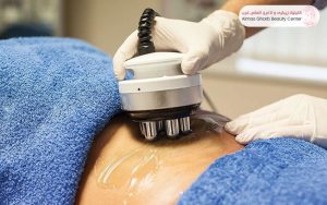 لاغری با دستگاه RF
