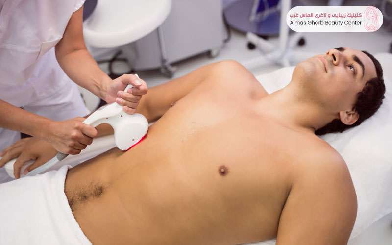 لیزر فول بادی