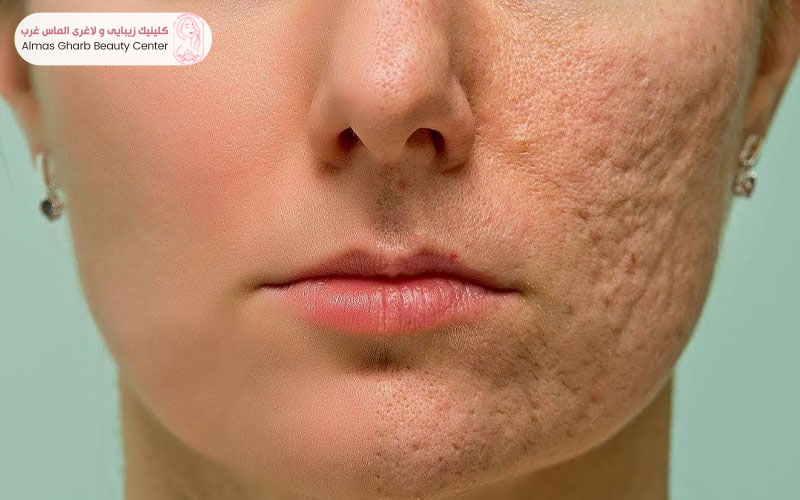 تغذیه، خواب و استرس چه تأثیری بر پوست دارند؟