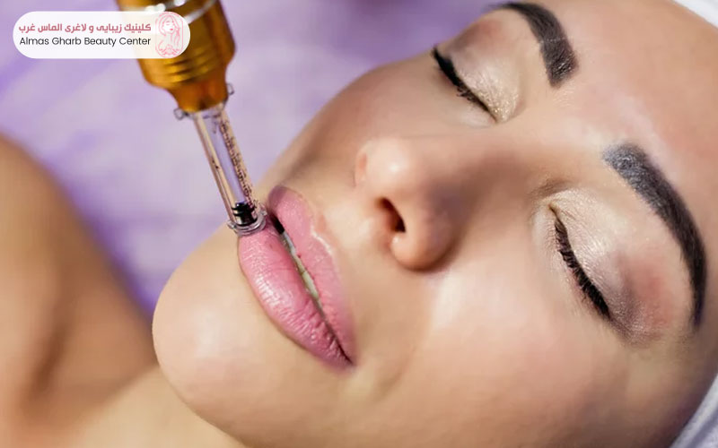 تخلیه ژل و تزریق آنزیم